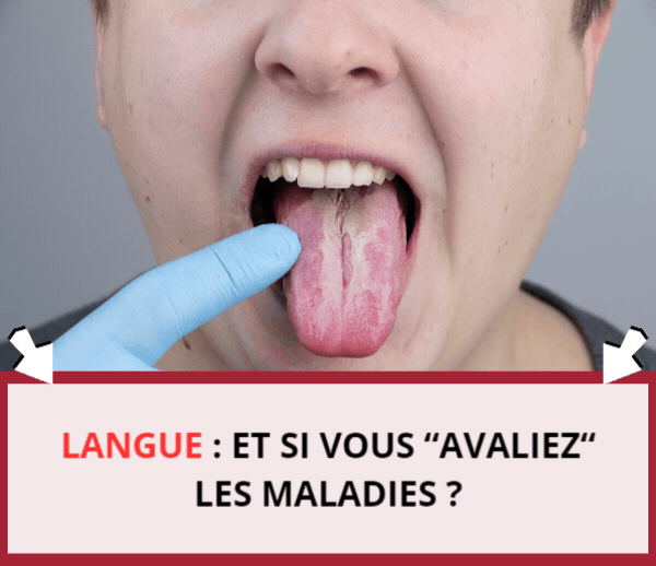 ABF x BUC – Multi-ads n°12