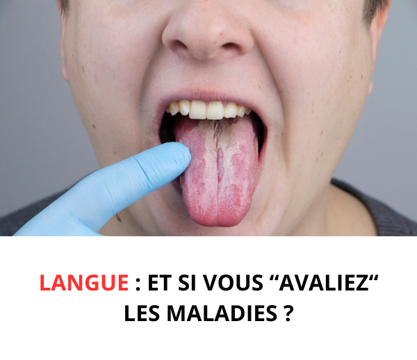 ABF x BUC – Multi-ads n°2
