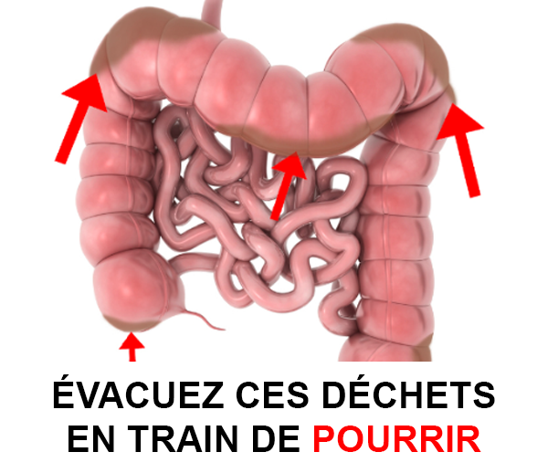 ABF x DCV – Multi-ads n°4