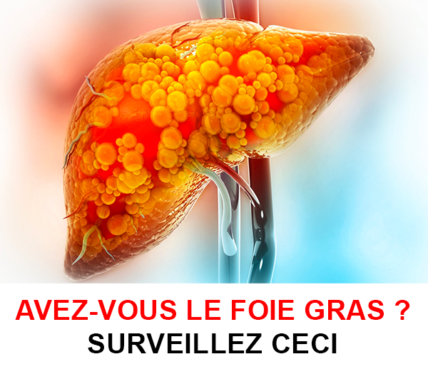 SDN x DDF – Multi-ads n°10