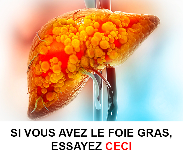 SDN x DDF – Multi-ads n°11