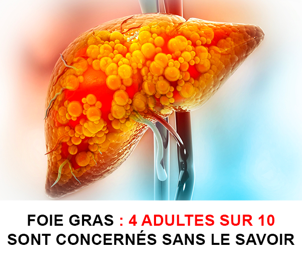 SDN x DDF – Multi-ads n°12