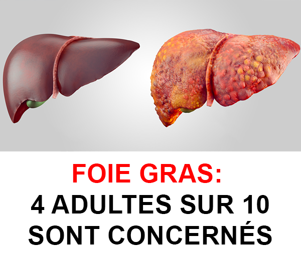SDN x DDF – Multi-ads n°7