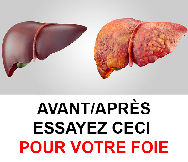 SDN x DDF – Multi-ads n°9