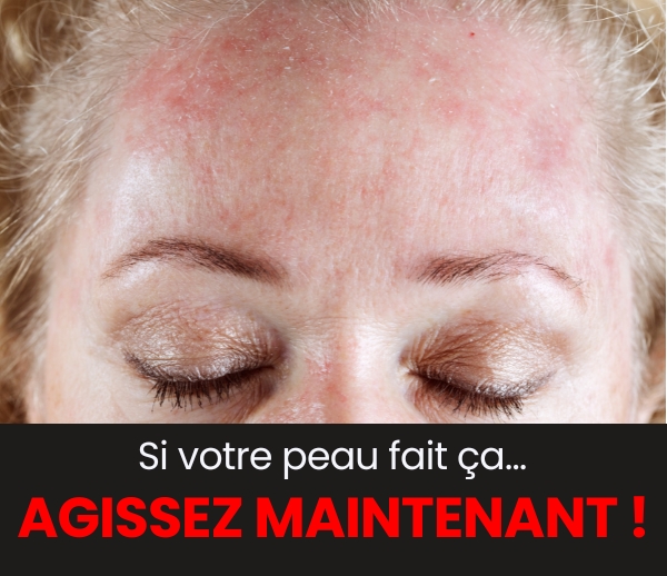 SDN x FAC – Multi-ads n°19