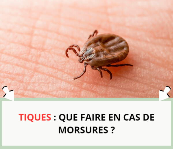 SDN x MOS – Multi-ads n°17