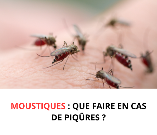 SDN x MOS – Multi-ads n°4