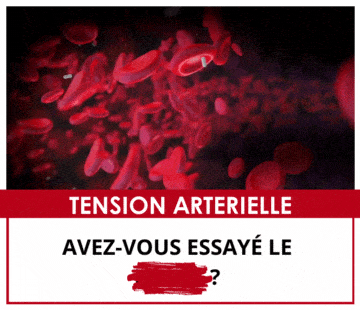 SDN x NUT – Multi-ads n°8