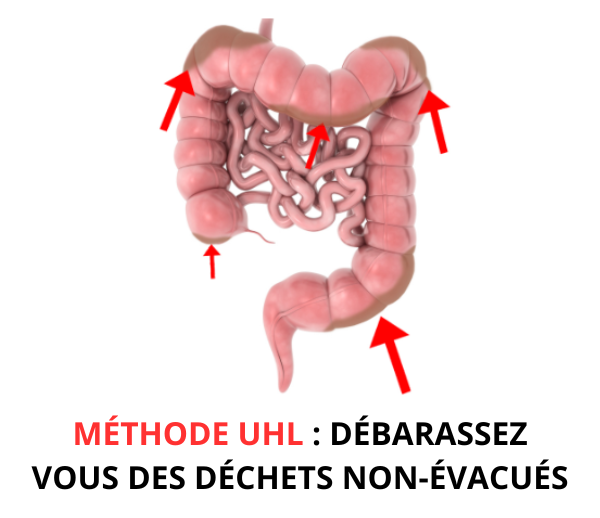 SDN x UHL – Multi-ads n°3