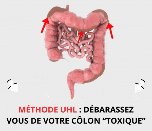 SDN x UHL – Multi-ads n°12