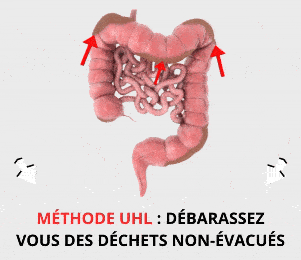 SDN x UHL – Multi-ads n°13