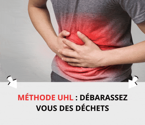 SDN x UHL – Multi-ads n°18