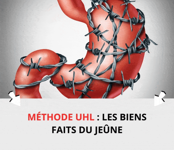SDN x UHL – Multi-ads n°20